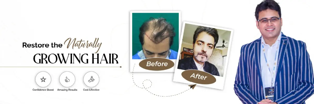 AKS Clinic – Leading Hair Transplant Clinic in Gurgaon aks clinic