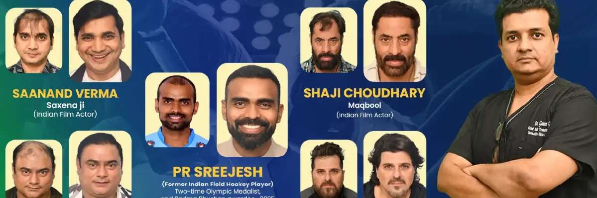 5. Dermalife Hair & Skin Clinic – Leading Hair Transplant Clinic in Delhi NCR Dermalife Hair & Skin Clinic – Leading Hair Transplant Clinic in Delhi NCR