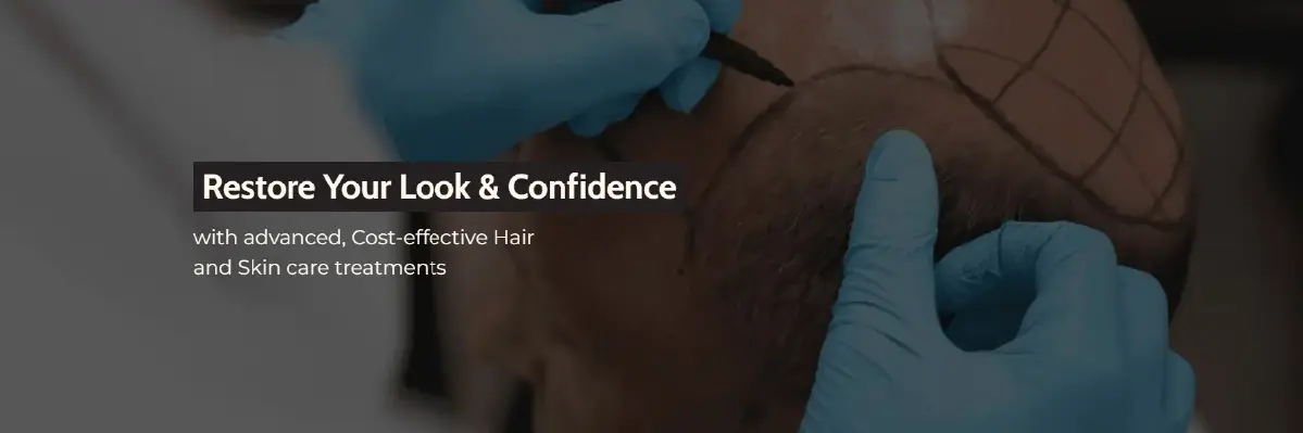 AK Clinics – Trusted Hair Transplant Clinic in Delhi NCR AK Clinics – Trusted Hair Transplant Clinic in Delhi NCR
